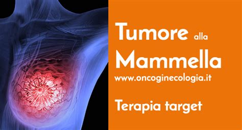 tipi di tumore alla mammella